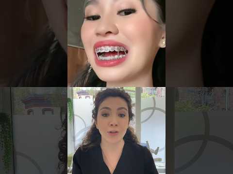 Shocking Truth About Dentists Changing Your Bite with Orthodontics