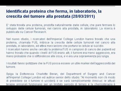 Motivo iperplasia prostatica Intervento chirurgico alla prostata Voronezh