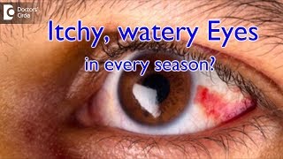 My eyes are always itchy and watery no matter the season or day. Why? - Dr. Sriram Ramalingam