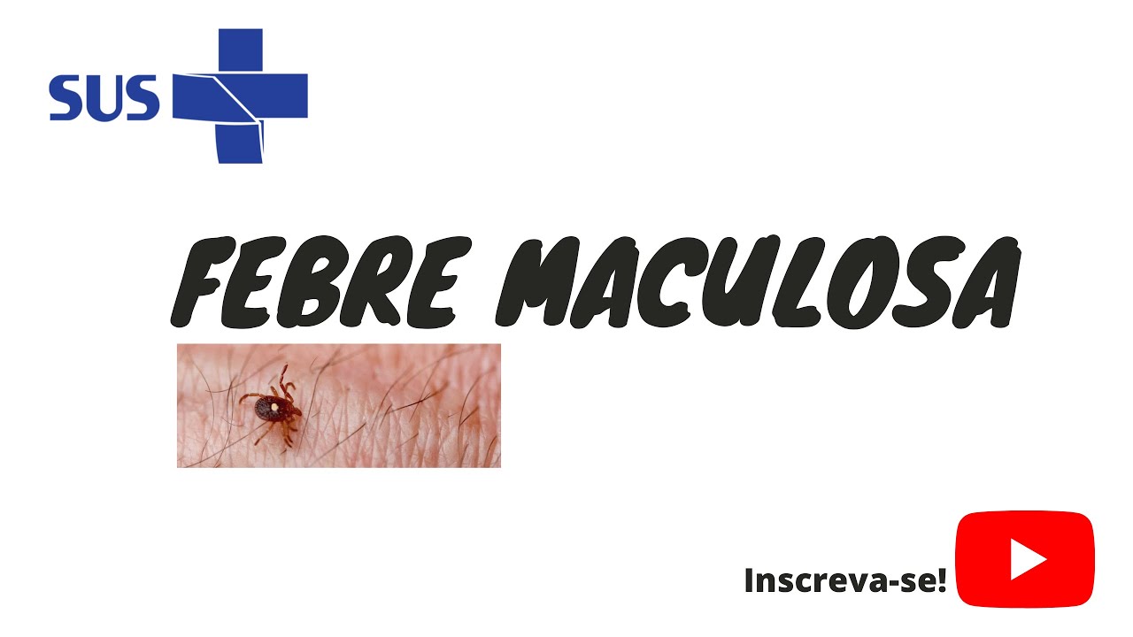 Febre maculosa - características, sintomas e prevenção