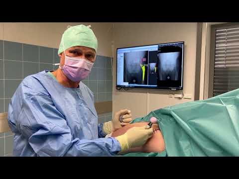 Hüftoperation am Kath. Krankenhaus Dortmund West