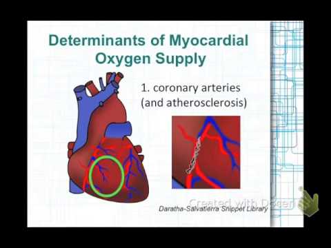 Salvatierra-Daratha -  MI-Pathophysiology-Myocardial O2 supply and demand