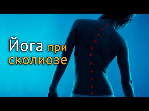 Видео уроки осанка Уплощен физиологический лордоз