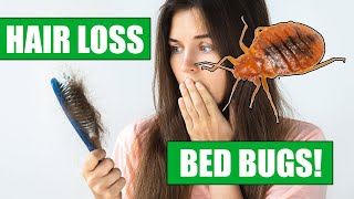 Do Bed Bugs cause Hair Loss? - A Story of Bed Bugs and Hair Loss - What to do