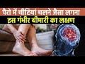 पैरो में चीटियां चलने जैसा लगना इस गंभ