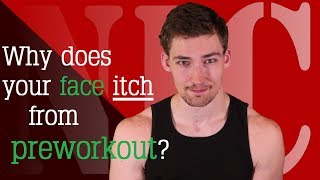 NIC 71b: Why does your face itch from preworkout?