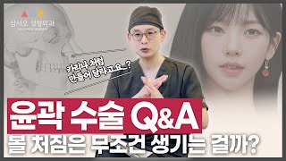 윤곽 수술, 누구나 연예인처럼 될 수 있을까? 연예인 사진을 들고와야 되는 이유!_[삼사오 성형외과]