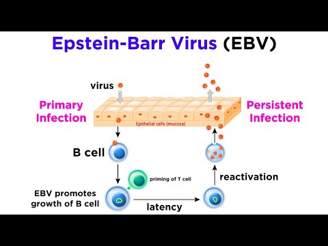 Mononucleosis (Epstein-Barr Virus)