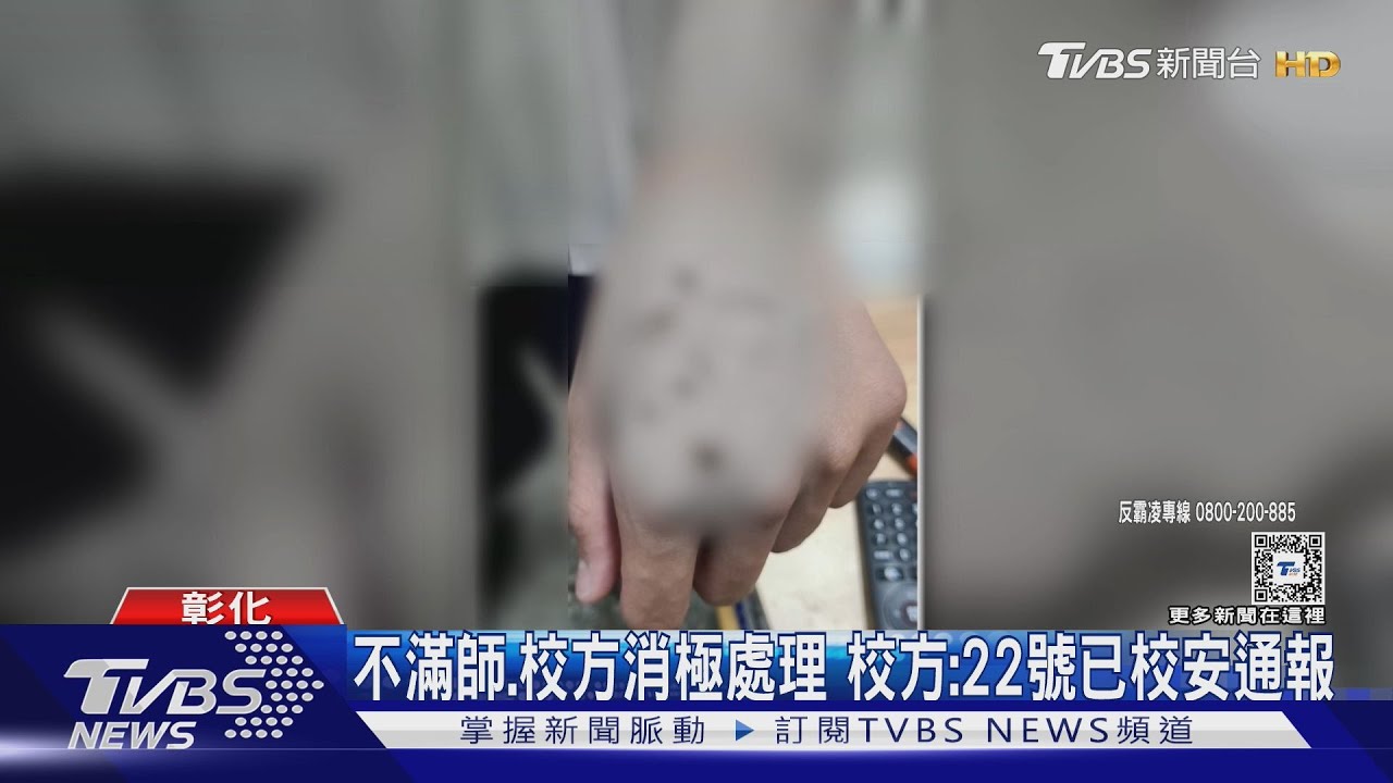 媽控國一兒 遭同學霸凌 遭搶外套傷見血