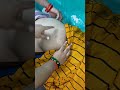 Im Injection Vlog Video
