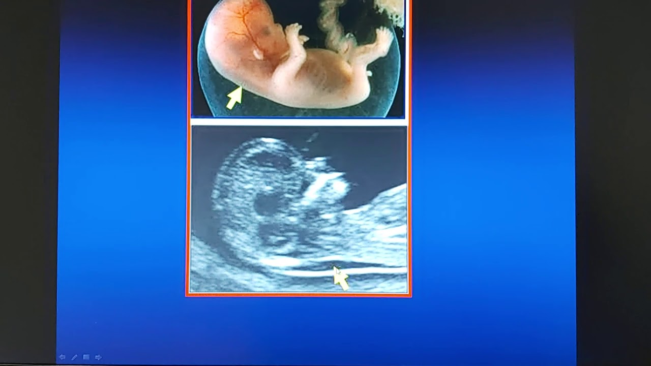 Informazioni sulla diagnostica prenatale