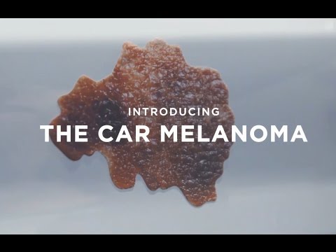 ⁣Car Melanoma