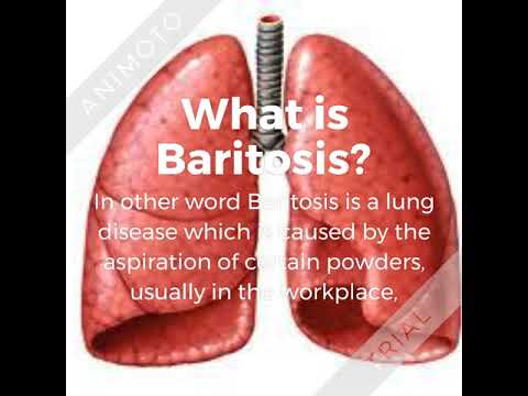 , title : 'What is Baritosis'