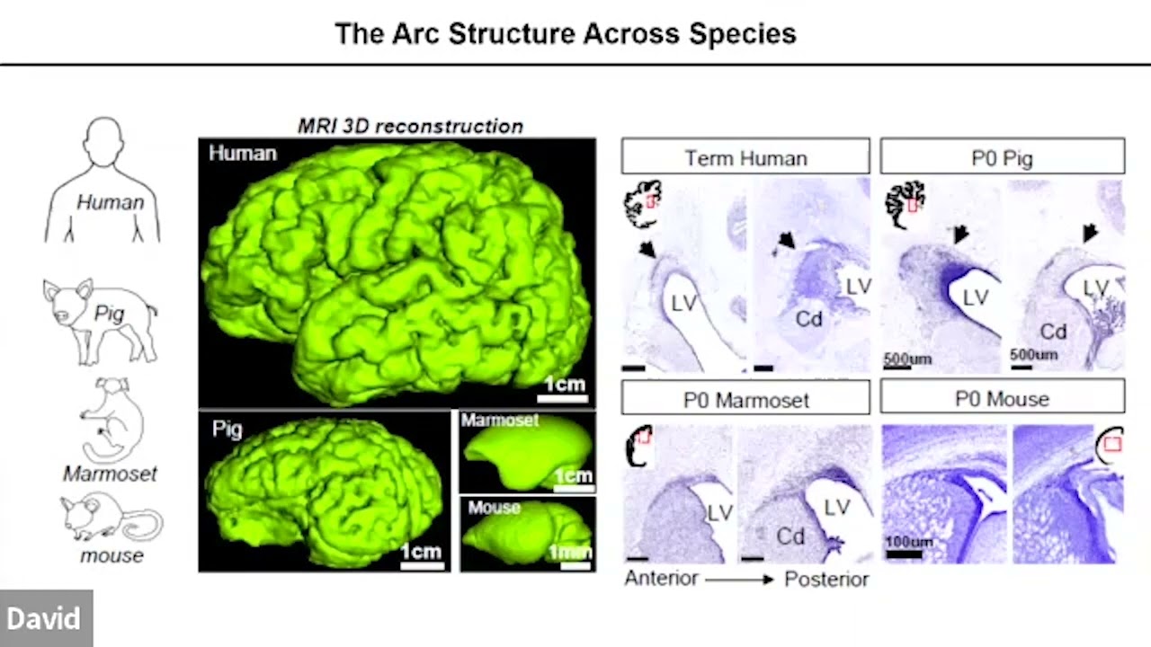 Mapping Postnatal Neuronal Migration: A Late Path to Neurodevelopmental Disorders