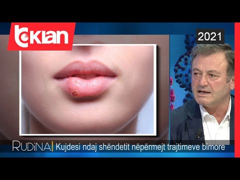 Ylli Merja tregon si te trajtojme herpesat me hudher dhe si te shpetojme nga era e keqe qe ato lene