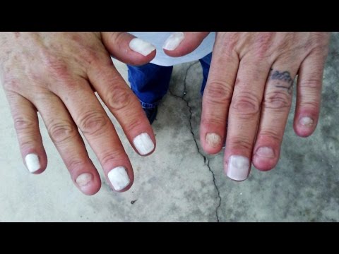 Watch lagu Images Videos Celebrity Biting Nails, Watch Images Celebrity Biting Nails free Watch, Watch Images Celebrity Biting Nails