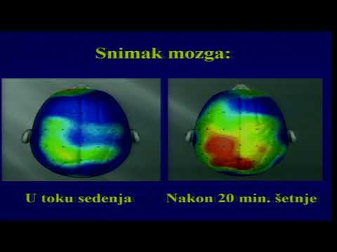 Kako da poboljsamo rad mozga - dr Dragan Ivanov
