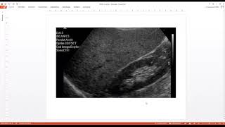 Copie de ImageMed 2018 Hang Out Echographie