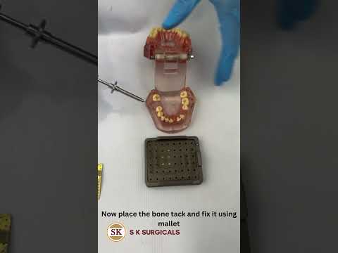 Gbr bone tack set  guided bone regeneration tack