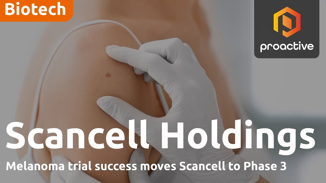  Melanoma trial success moves Scancell to phase III