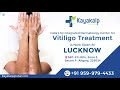 New Lucknow Center Of Kayakalp Global 9599794433