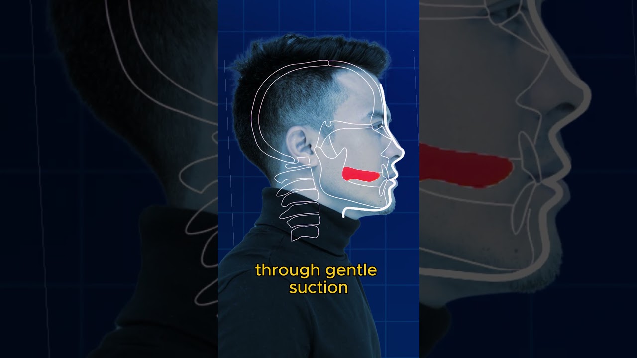 Soft Mewing Vs. Hard Mewing🤔