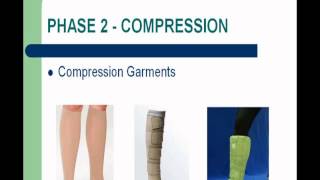 preview picture of video 'Lymphedema Webinar: Newton-Wellesley Hospital'