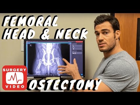 Femoral Head & Neck Ostectomy