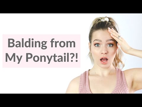 download lagu mp3 mp4 Can Wearing Your Hair In A Ponytail Cause Hair Loss, download lagu Can Wearing Your Hair In A Ponytail Cause Hair Loss gratis, unduh video klip Can Wearing Your Hair In A Ponytail Cause Hair Loss