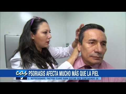 Fukortsin contra la eccema Vobenzim a la psoriasis las revocaciones