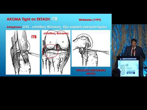 Νικολόπουλος Δ. - Ολική αρθροπλαστική στο βλαίσο γόνατο. Τι δυσκολίες υπάρχουν;
