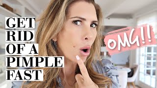 My Secret to Getting Rid of a HUGE red PIMPLE overnight! (NOBODY has shared this before!!)