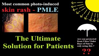 Most common sunlight induced skin rash - PMLE: Ultimate guide for patients