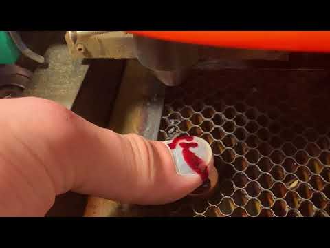 Ouch: Dude uses a laser cutter to make holes in his nail to drain a blood blister