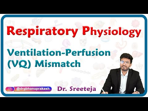 Ventilation-perfusion (V/Q) mismatch : Respiratory physiology USMLE Step 1