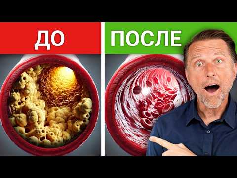 Еда, которая защищает от тромбов и инсульта🔥