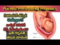 Placenta Previa | Is normal delivery possible | Complications during delivery | pregnancy