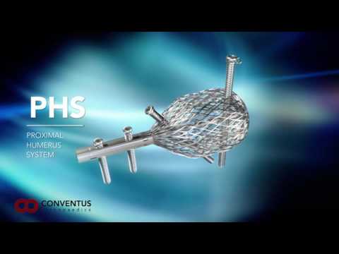 The Conventus Cage Proximal Humerus System