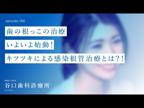 第188話 歯の根っこの治療–天然歯によるキツツキで感染根管治療とは⁉️-第185、186話参照 ❗️手に比べて、実際どうなの⁉️