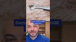 Doctor reacts to massive, dilated pore! #blackhead #pimplepop #dermreacts #doctorreacts