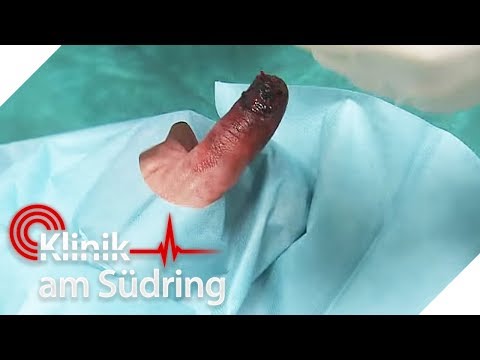 Gribok der Nägel 20 Jahre als zu heilen Das Mittel für die schnelle Behandlung gribka