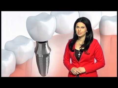 Tako stoje stvari - Nazdravlje - Zubni implanti - 01.12.2017.