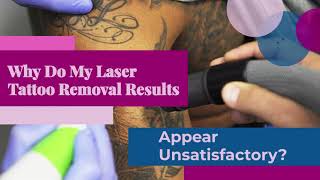 Why Do My Laser Tattoo Removal Results Appear Unsatisfactory?