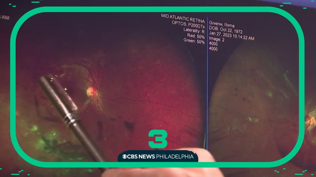 Screening event aims to save vision for people with diabetes