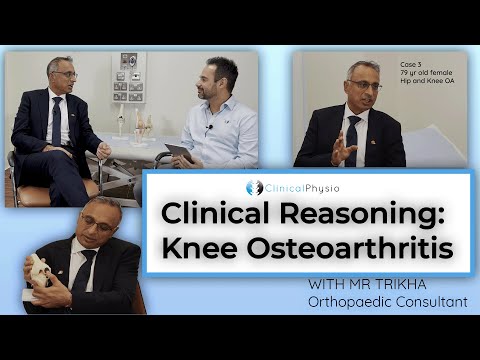 Everything you need to know about Knee Osteoarthritis | Expert Guide with Orthopaedic Surgeon
