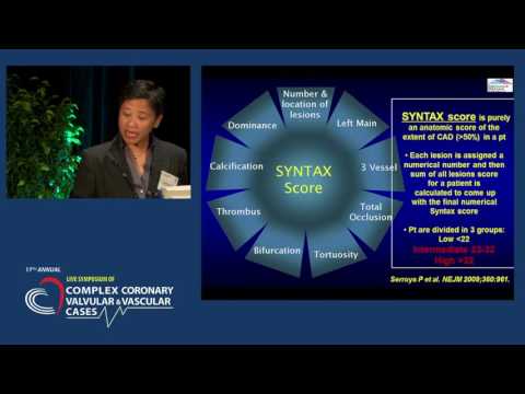 Stratification of Multivessel CAD: Meds, PCI or CABG?