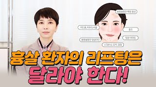 흉살 부작용 생긴 후 리프팅 시술, 효과 없으셨다구요? 리프팅. 손해보지 않고 제대로 받는 법