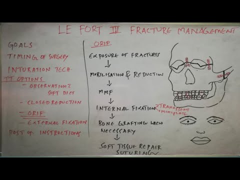 Le fort III fracture management