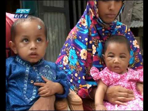 চিকিৎসা খরচ চালাতে গিয়ে সর্বস্বান্ত অভিভাবক