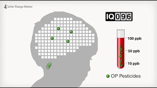 Little Things Matter: The Impact of Toxins on the Developing Brain Little Things Matter: The Impact of Toxins on the Developing Brain
